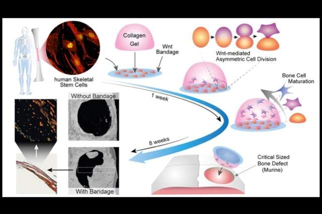 بانداژی که استخوان‌های آسیب دیده را ترمیم می‌کند
