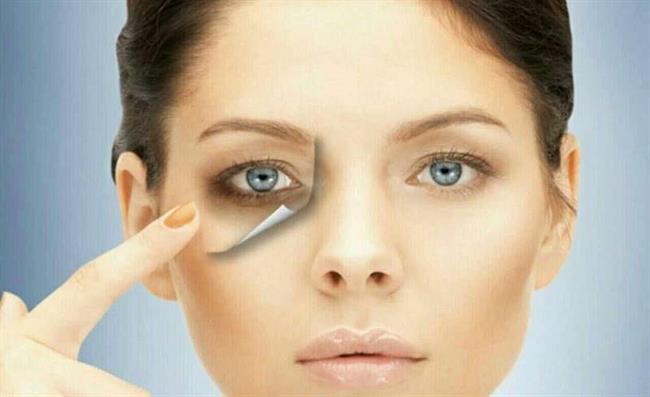 کاهش گودی و سیاهی زیر چشم را با ترک 6 عادت