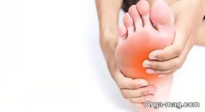روش های درمان درد کف پا