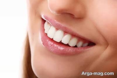 تاثیر دندان های سفید در زیبایی