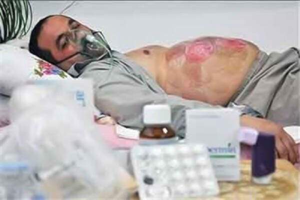 «صدام» با تسلیحات شیمیایی خود چه جنایاتی انجام داد؟+ فیلم