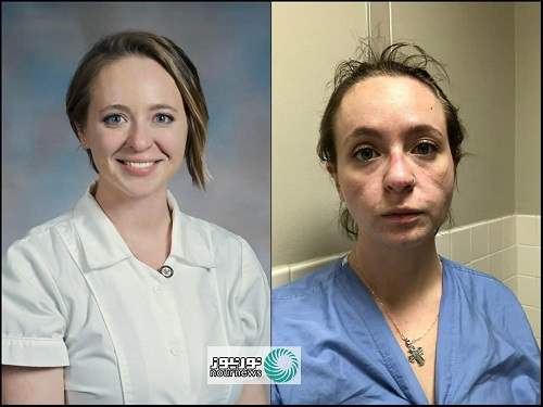 پرستار آمریکایی قبل و بعد از شیوع کرونا