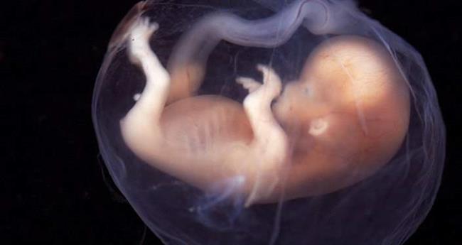 A human embryo