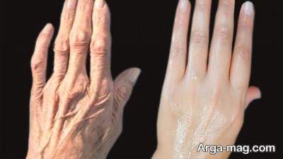 رژیم غذایی مناسب برای درمان خشک شدن پوست دست 