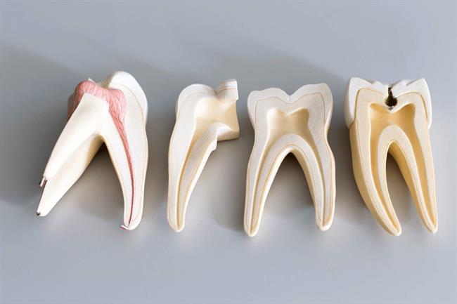 علائم درد ریشه دندان