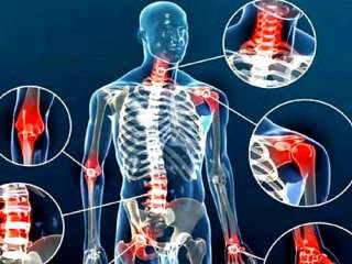 آرتروز اولیه بدون هیچ علت خاصی ایجاد می شود