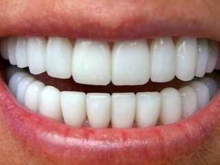 4 روش ساده برای جرم گیری دندان‌ها در منزل