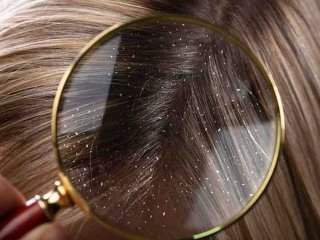 10 اشتباه رایجی که به موی شما آسیب می‌رساند+ تصاویر