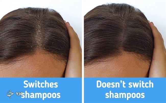 10 اشتباهات رایجی که به موی شما آسیب می‌رساند+ تصاویر