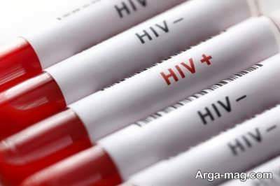 ارتباط بیماری ایدز و جوش مقعدی