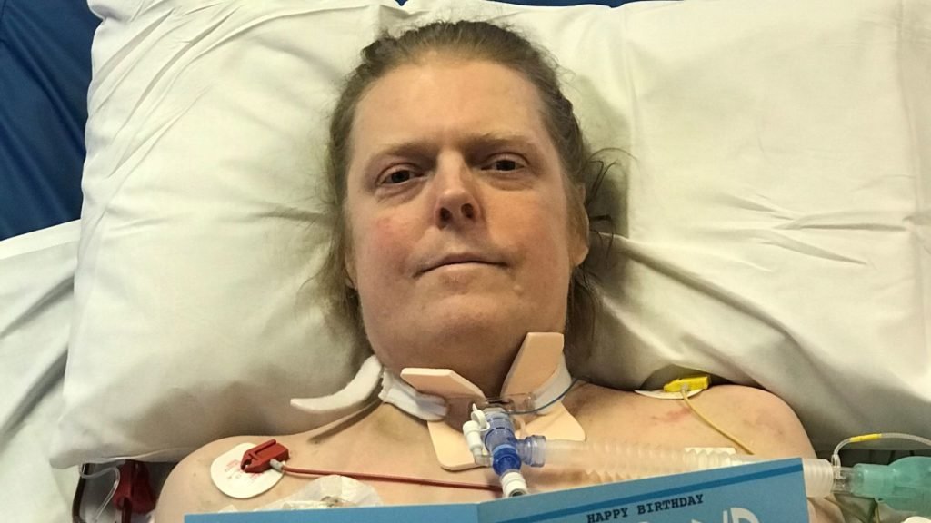 بیمار مبتلا به کرونا بعد از 14 ماه جدال با مرگ درگذشت
