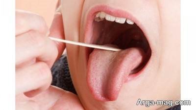 ازلاعات مفیدی دربارع سرطان دهان 