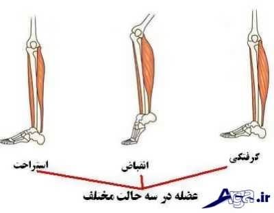 علل و درمان خانگی گرفتگی عضلانی