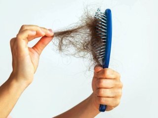 پنج عامل مهم ریزش موها را بشناسید