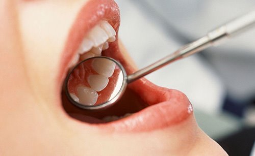 دلایل دندان درد شبانه؛ 8 نشانه هشداردهنده