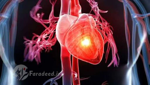 مطالعه نشان می‌دهد که چگونه علائم قلبی در زنان درمان می‌شود