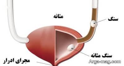 انواع خواص گیاه چوبک