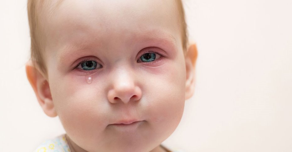 چه چیزی باعث قرمزی دور چشم کودک می‌شود؟