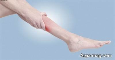 راهکارهای خانگی مورد استفاده در درمان پا درد شبانه