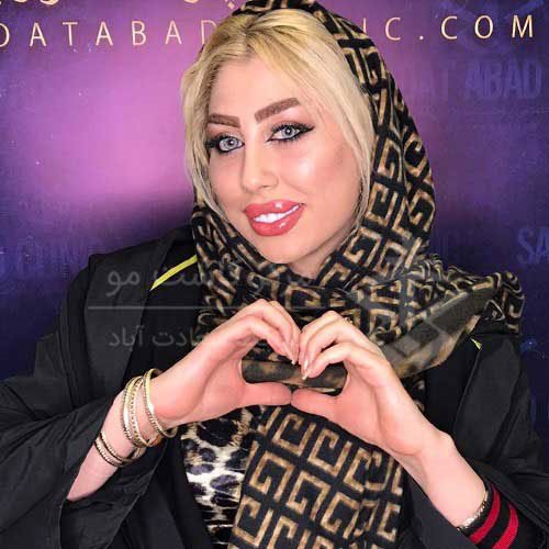 مزایای تزریق چربی بایوفت