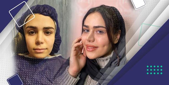 بایوفت دکتر لاغری