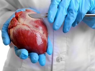 مراقب های پس از عمل جراحی قلب باز که باید در خانه انجام دهید