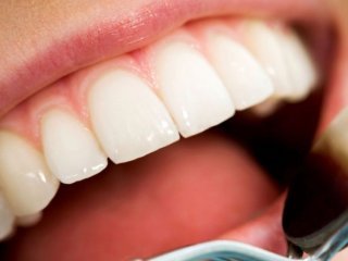 5 عادت نادرستی که دندان‌هایتان را خراب می‌کند