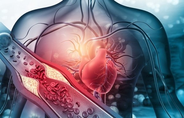 5 علامت حمله قلبی که باید بشناسید!