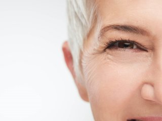 درمان چروک دور چشم با 8 روش خانگی مؤثر