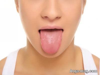 دلایل تلخی دهان در افراد