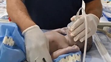 تلاش‌های یک پزشک برای به گریه انداختن نوزاد تازه متولد شده را ببینید/ قلبش نمی‌زنه (فیلم)
