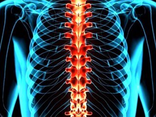 دلایل انحراف در ستون فقرات و راهکارهای درمان