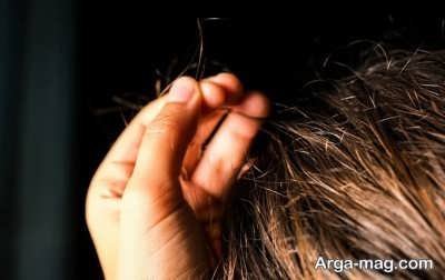 انواع بیماری مو و راه های مطمئن برای درمان آن ها