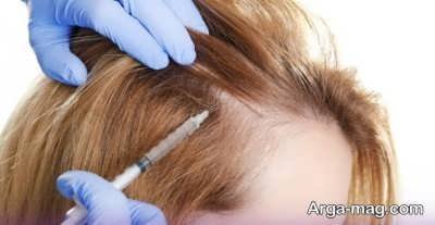 راهکارهای موثر درمان بیماری های مو