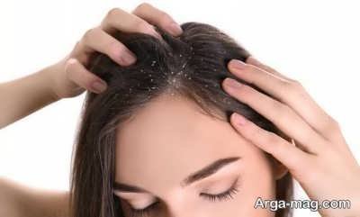 معرفی انواع بیماری مو و روش های درمان آن