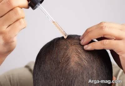 انواع بیماری مو و راه های درمان آن 