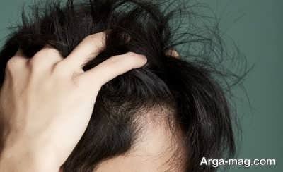 راه های درمان بیماری های مو