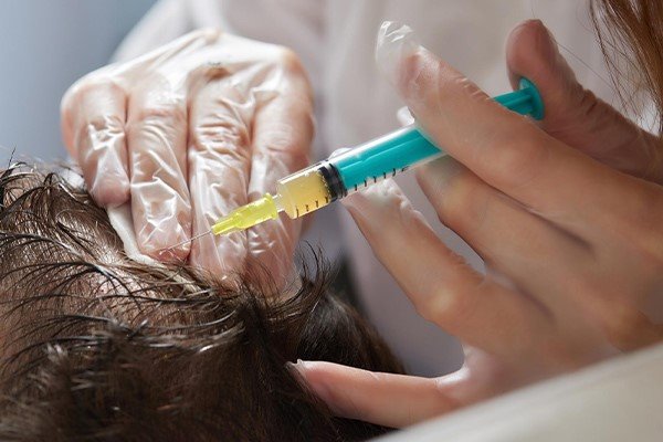 درمان قطعی ریزش موی سکه ای + بهترین روش های درمان 