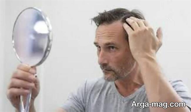 روش های ساده و روزانه برای تقویت موی سر مردان