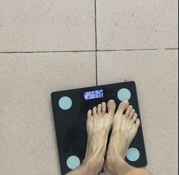 این زن چینی به لاغر شدن اعتیاد دارد؛ 25 کیلو وزن!/ عکس