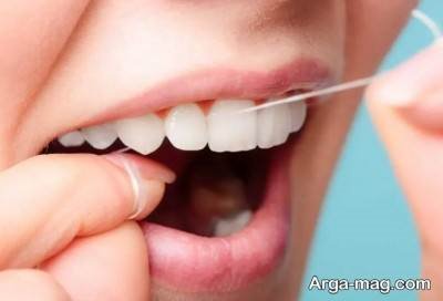 رعایت بهداشت دهان از راه های نگهداری بهتر از کامپوزیت دندانی 