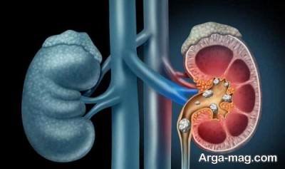 موارد تجویز قرص سیستون و ممنوعیت های استفاده از این دارو