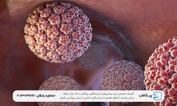 مشکلات جدی در صورت عدم درمان HPV به همراه درمان قطعی