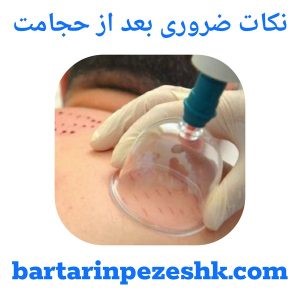 نکات ضروری حجامت