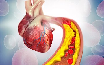 این گیاه دارویی سبب کاهش کلسترول می‌شود