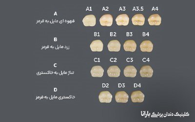 انواع رنگ لمینت دندان