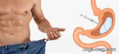 از مزایا و معایب بوتاکس معده چه می دانید؟