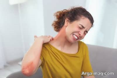 بیماری آنافیلاکسی