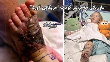 نجات معجزه‌آسای دختر 15 ماهه پس از گزش مار زنگی در آریزونا (فیلم)