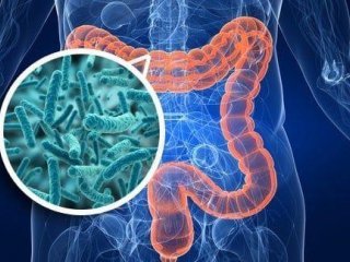 ارتباط میکروبیوم روده با یک سندرم زنانه